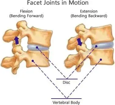 illustration showing facet joints in motion, and the position of the disc and vertebral body change between flexion - bending forward - and extension - bending backward.